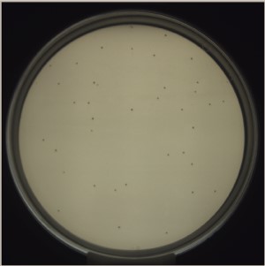 Candida detection last image