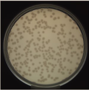 Pseudomonas detection last image