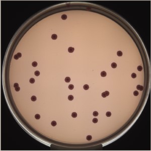 E coli plate last image