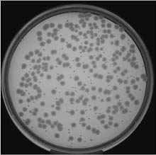 pour plate of mixed sample of E coli and C albicans