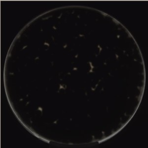 マイクロバイオPDA　 エクソフィアラ検出　最終画像