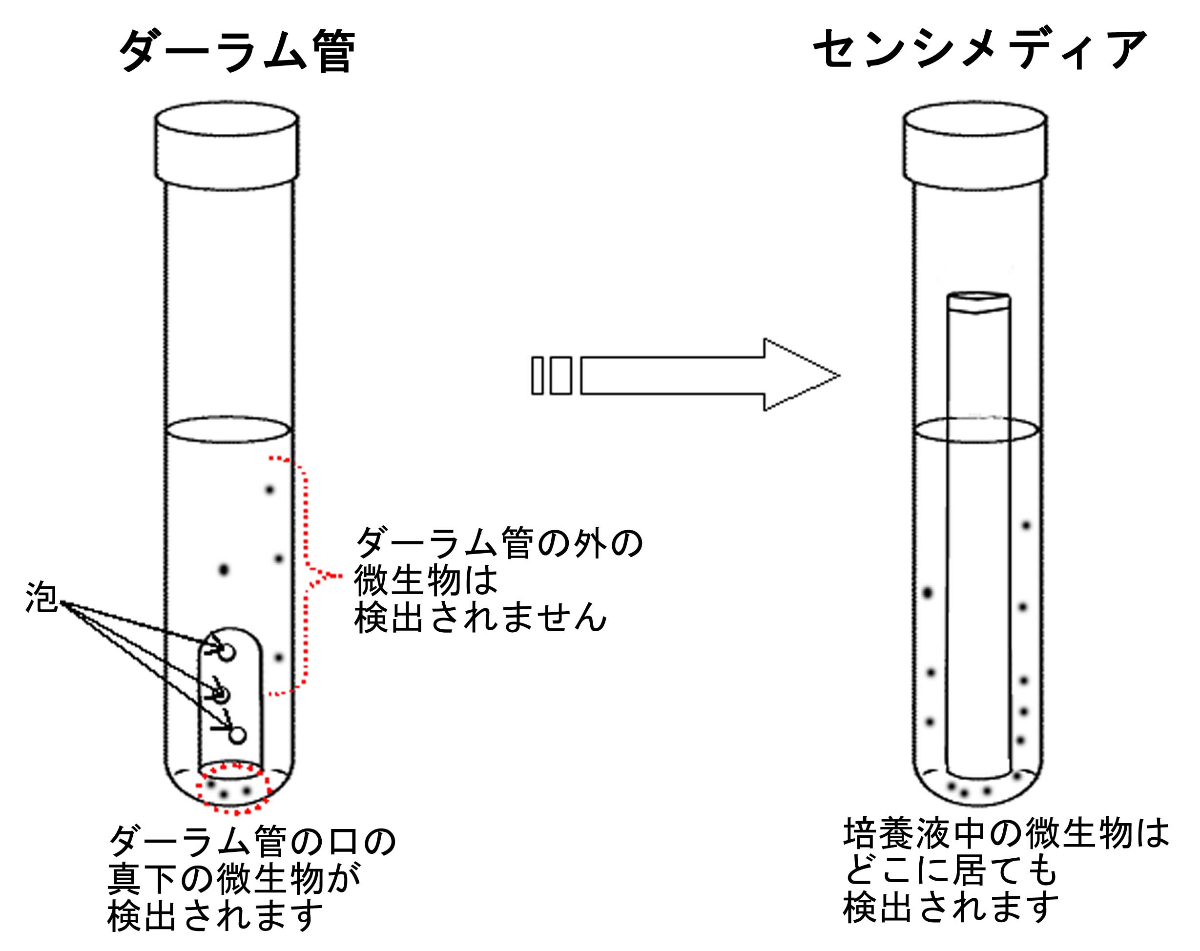 ダーラム管からセンシメディアへ